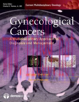 [AME]Gynecologic Cancers: A Multidisciplinary Approach to Diagnosis and Management