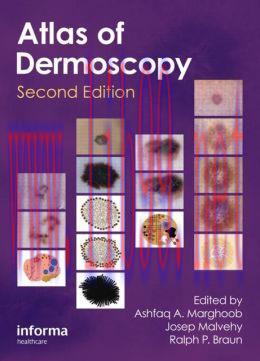 [AME]An Atlas of Dermoscopy, 2nd Edition