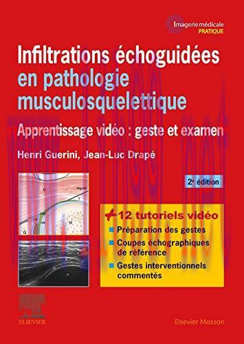 [AME]Infiltrations &eacute;choguid&eacute;es en pathologie musculosquelettique: Apprentissage vid&eacute;o : geste e...