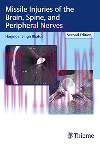 [AME]Missile Injuries Of The Brain Spine And Peripheral Nerves, 2nd edition (Original PDF)