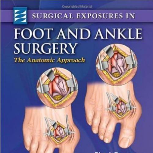 Surgical Exposures in Foot & Ankle Surgery _ The Anatomic Approach - deBoer, Piet(Author)