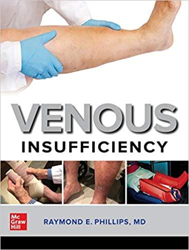 Venous Insufficiency