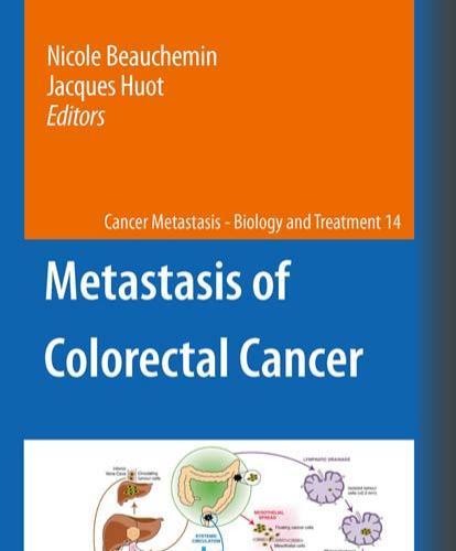 Metastasis of Colorectal Cancer