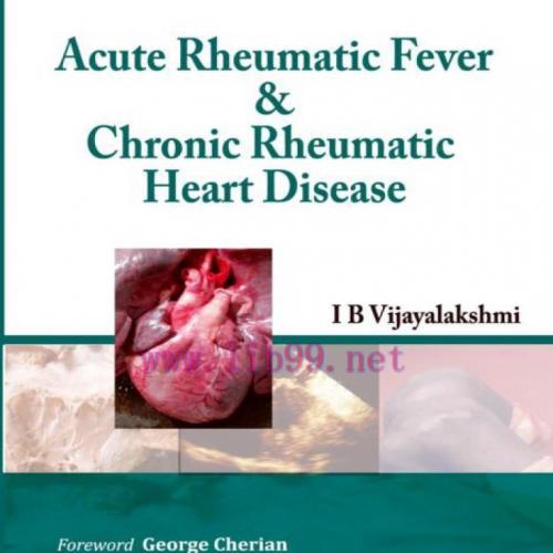 [AME]Acute Rheumatic Fever and Chronic Rheumatic Heart Disease (Epub + Converted PDF)