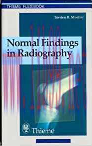 [PDF]Normal Findings in Radiography