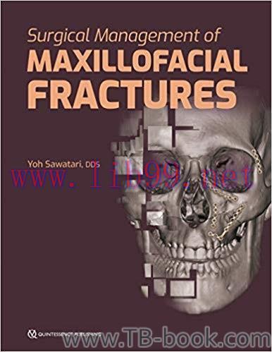 Surgical Management of Maxillofacial Fractures 1st Edition by Yoh Sawatari