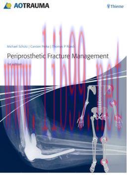 [AME]Periprosthetic Fracture Management (ORIGINAL PDF from_ Publisher)