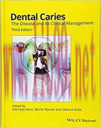 [PDF]Dental Caries: The Disease and Its Clinical Management 3rd Edition