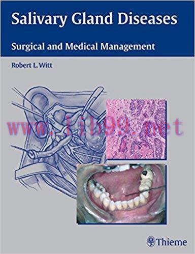 [PDF]Salivary Gland Diseases - Surgical and Medical Management