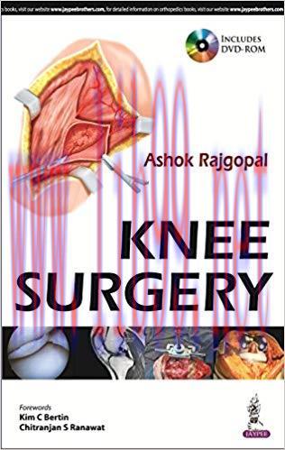 [PDF]Knee Surgery (Ashok Rajgopal)