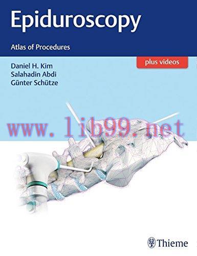 [AME]Epiduroscopy: Atlas of Procedures (EPUB)