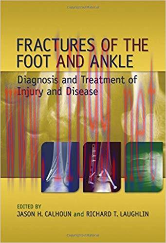 [PDF]Fractures of Foot and Ankle