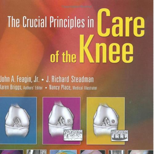 Crucial Principles in Care of the Knee - pdq