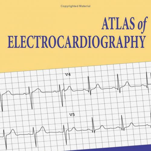 Atlas of Electrocardiography