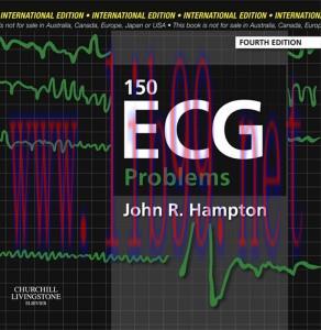 [AME]150 ECG Problems, 4e (Original PDF)
