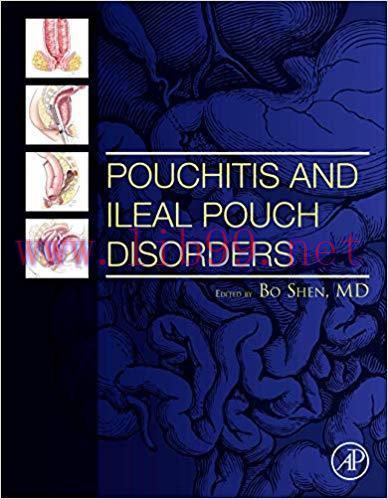 [PDF]Pouchitis and Ileal Pouch Disorders: A Multidisciplinary Approach for Diagnosis and Manage...