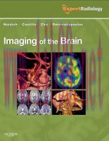 [PDF]Imaging of the Brain