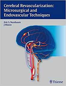 Cerebral Revascularization - Microsurgical and Endovascular Techniques