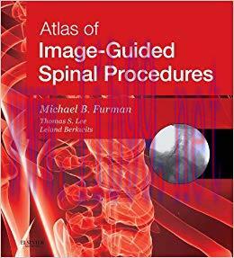 (PDF)Atlas of Image-Guided Spinal Procedures E-Book 1st Edition