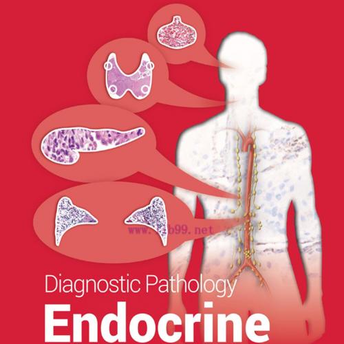 [AME]Diagnostic Pathology: Endocrine, 3rd Edition (EPUB)