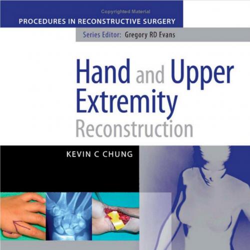 Hand And Upper Extremity Reconstruction
