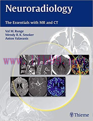 [PDF]Neuroradiology - The Essentials with MR and CT [Runge, Val M Smoker] + Videos