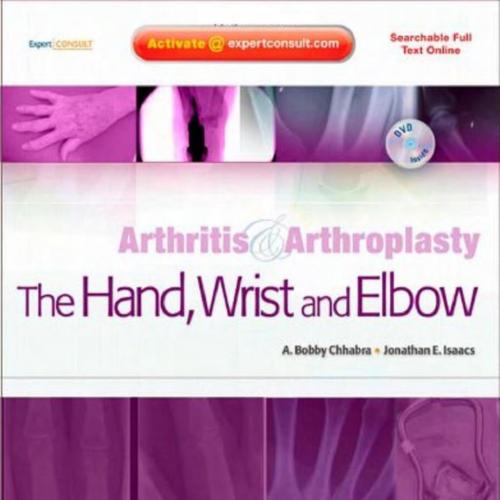 Arthritis and Arthroplasty The Hand, Wrist and Elbow,1e