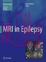 [PDF]MRI in Epilepsy