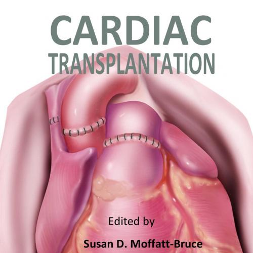 Cardiac Transplantation