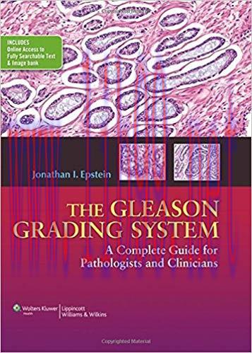 [PDF]The GLEASON GRADING SYSTEM+CHM版
