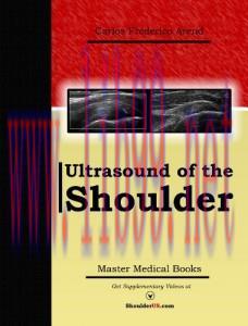 [AME]Ultrasound of the Shoulder (Musculoskeletal Ultrasound Series) (EPUB)