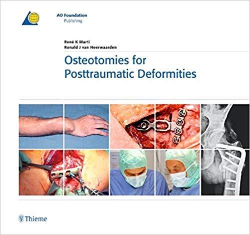 Osteotomies for Posttraumatic Deformities 2008