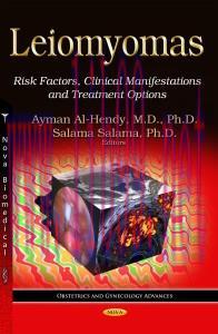 [AME]Leiomyomas: Risk Factors, Clinical Manifestations and Treatment Options