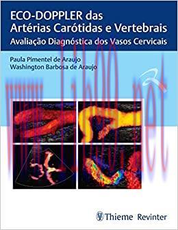 [AME]ECO-DOPPLER das Art&eacute;rias Car&oacute;tidas e Vertebrais: Avalia&ccedil;&atilde;o Diagn&oacute;stica dos Vasos Cervicais...