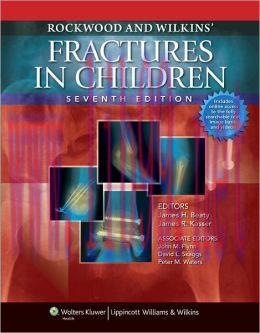 [AME]Rockwood and Wilkins&rsquo; Fractures in Children, 7th Edition (ORIGINAL PDF from_ Publisher)