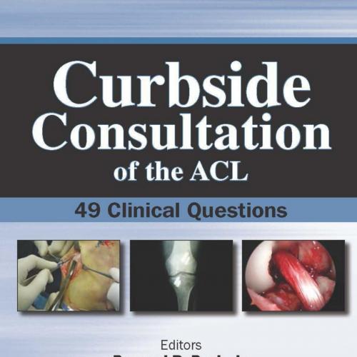 Curbside Consultation of the ACL 49 Clinical Questions