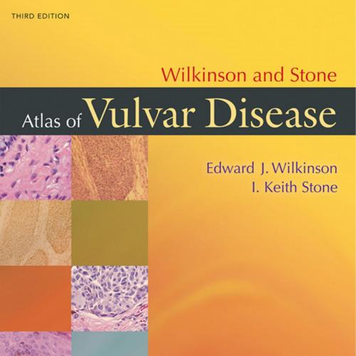 Wilkinson and Stone Atlas of Vulvar Disease, 3rd Edition - Wei Zhi