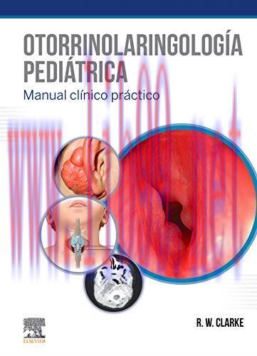 [AME]Otorrinolaringolog&iacute;a pedi&aacute;trica (Original PDF)