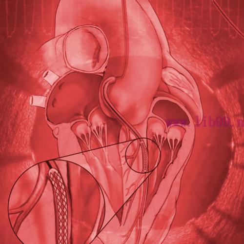 [AME]Mayo Clinic Interventional Cardiology Online Board Review 2020 (CME VIDEOS)