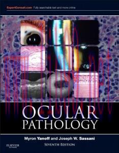 [AME]Ocular Pathology: Expert Consult - Online and Print, 7e (ORIGINAL PDF from_ Publisher)