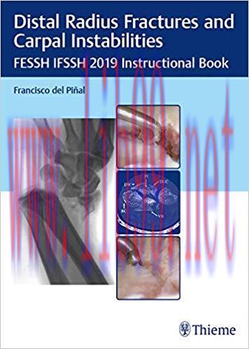 [PDF]Distal Radius Fractures and Carpal Instabilities