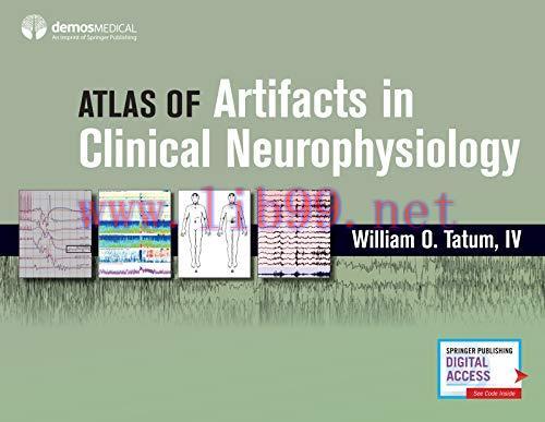 [AME]Atlas of Artifacts in Clinical Neurophysiology (Original PDF)