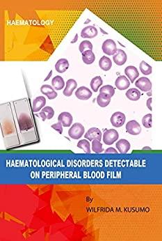 (PDF)Haematological diseases detectable on peripheral blood film