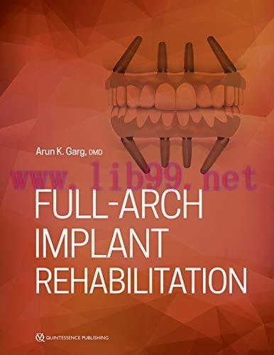 [AME]Full-Arch Implant Rehabilitation