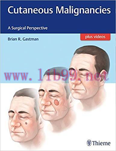 [PDF]Cutaneous Malignancies - A Surgical Perspective