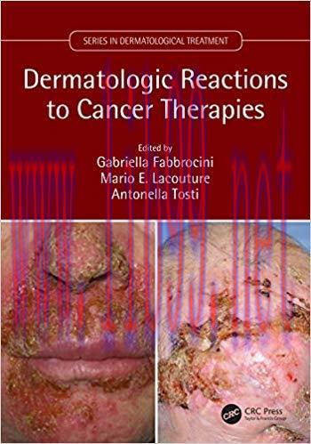 [PDF]Dermatologic Reactions to Cancer Therapies