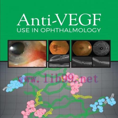 [AME]Anti-VEGF Use in Ophthalmology (EPUB)