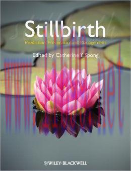 [AME]Stillbirth: Prediction, Prevention and Management