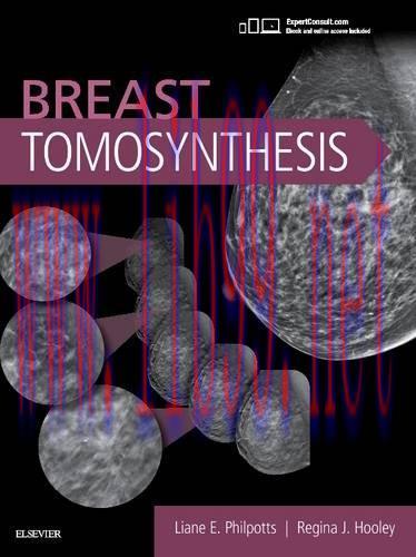 [AME]Breast Tomosynthesis (PDF)