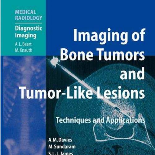 Imaging of Bone Tumors and Tumor-Like Lesions